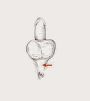 μύες ισχύος και την έντασή τους για την αύξηση της ισχύος